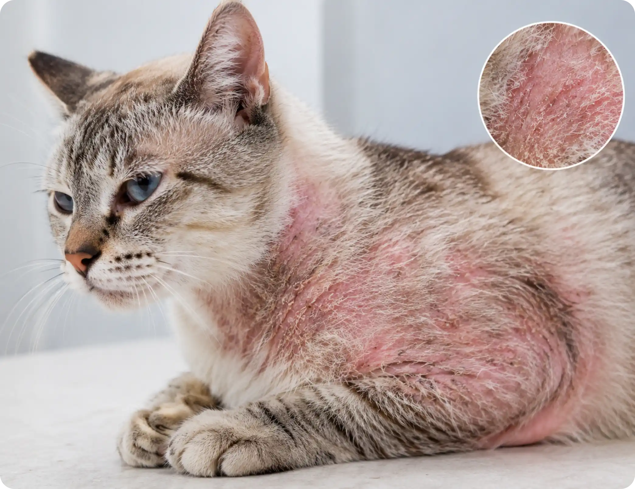 Dry Skin & Allergic Dermatitis